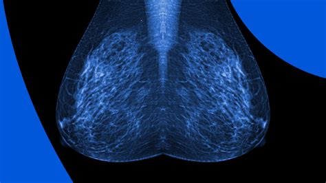 mammogram porn|Breast Screening Porn Videos .